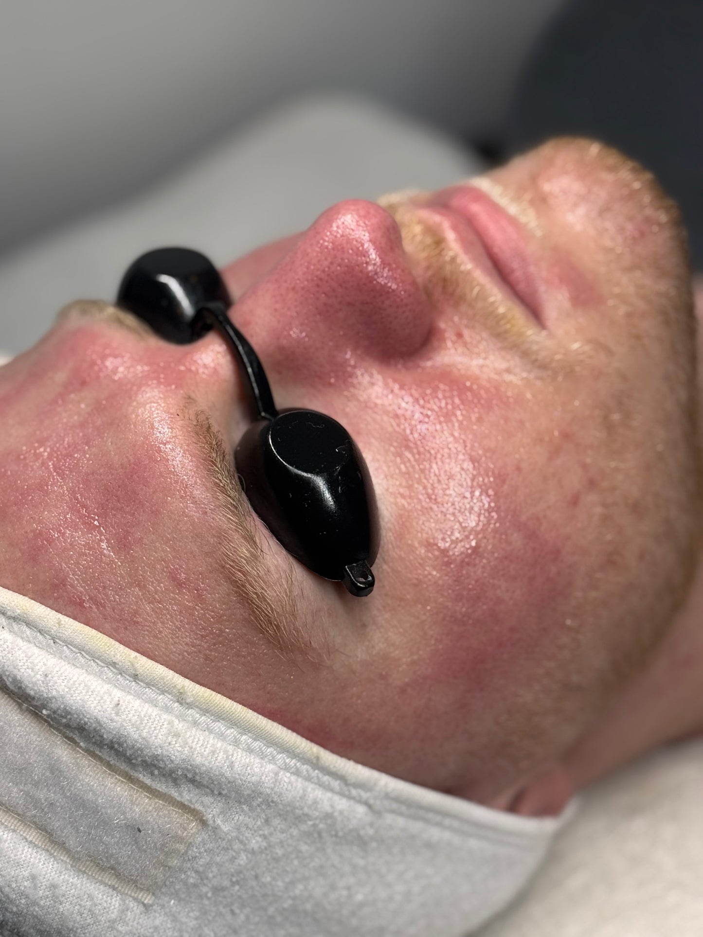HIGIENE FACIAL PROFUNDA + RUTINA PERSONALIZADA