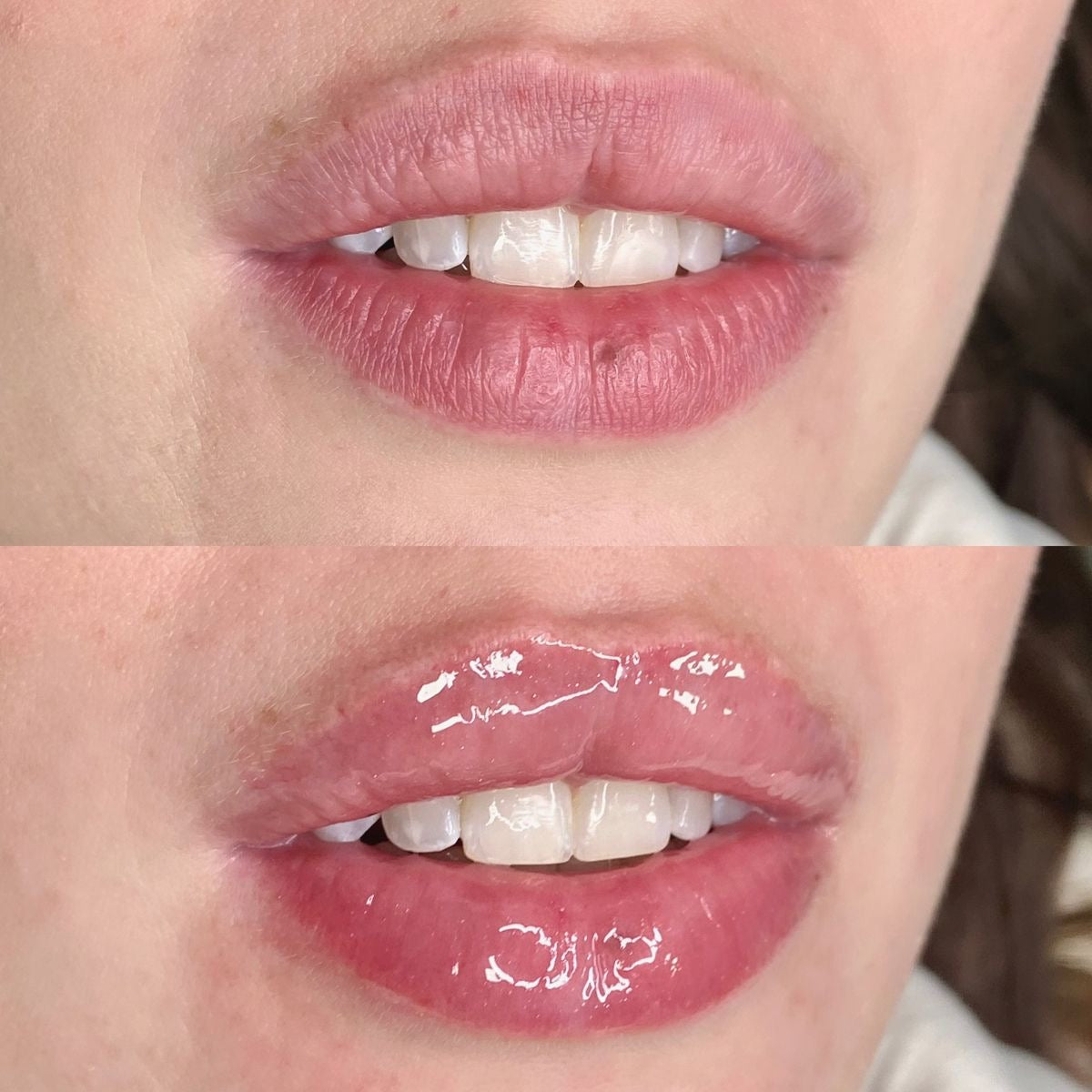Bálsamo reparador de labios