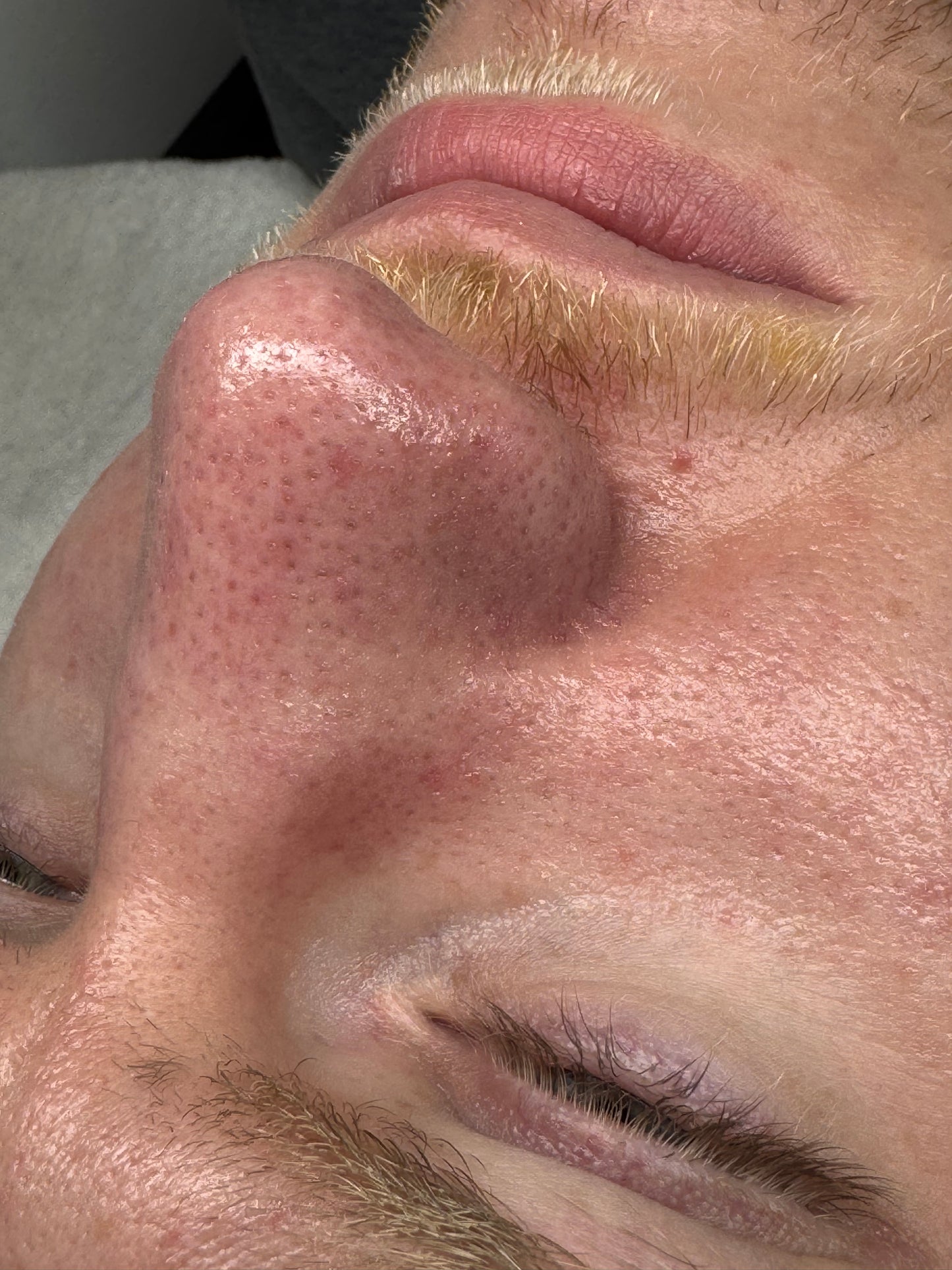 HIGIENE FACIAL PROFUNDA + RUTINA PERSONALIZADA