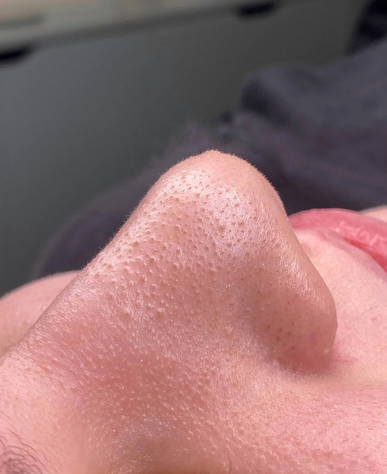Exfoliante facial