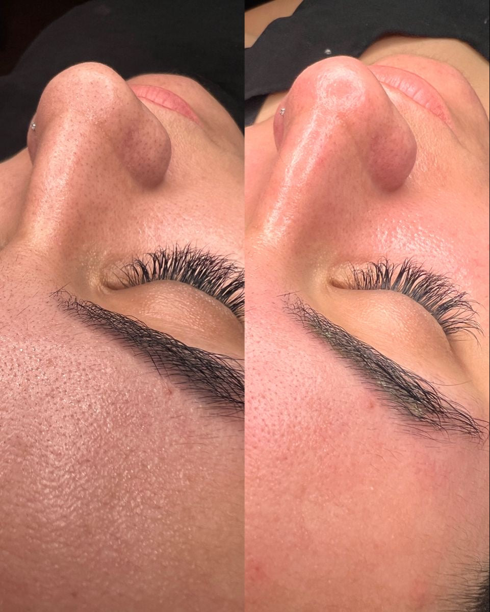 Curso higiene facial profunda (Presencial )