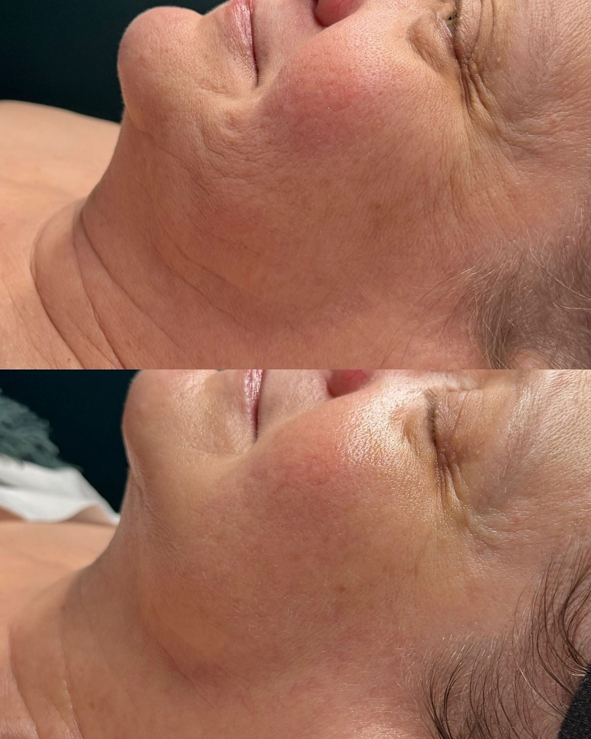 HIGIENE FACIAL PROFUNDA + RUTINA PERSONALIZADA