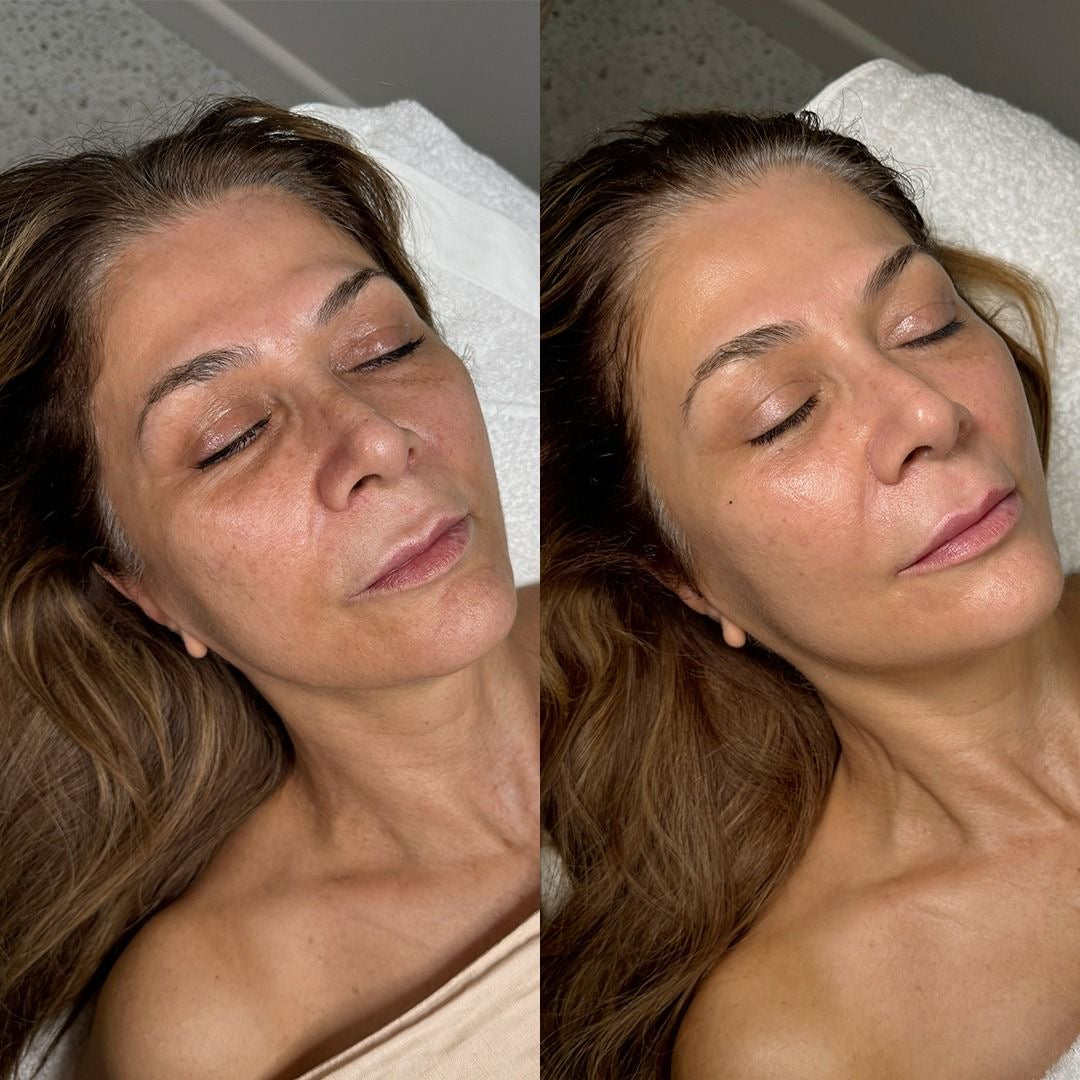 HIGIENE FACIAL PROFUNDA + RUTINA PERSONALIZADA