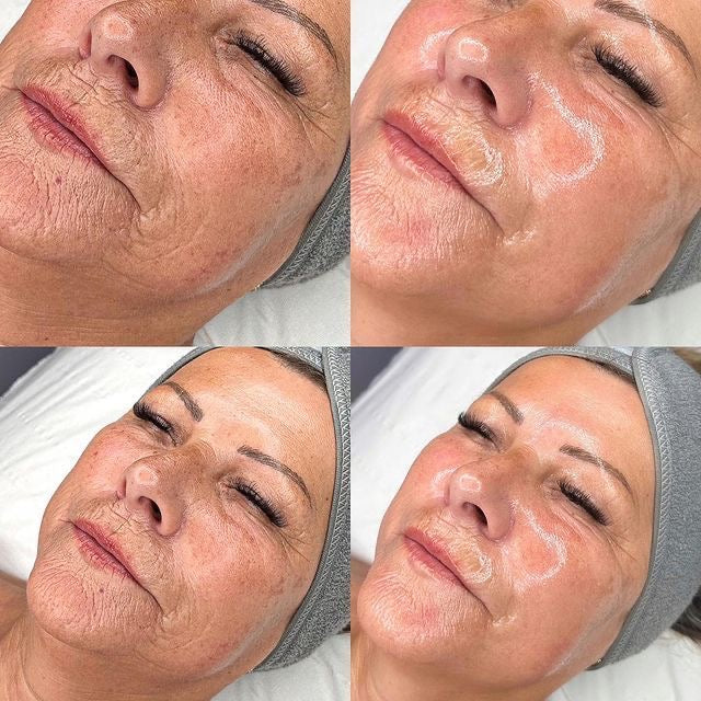 HIGIENE FACIAL PROFUNDA + RUTINA PERSONALIZADA