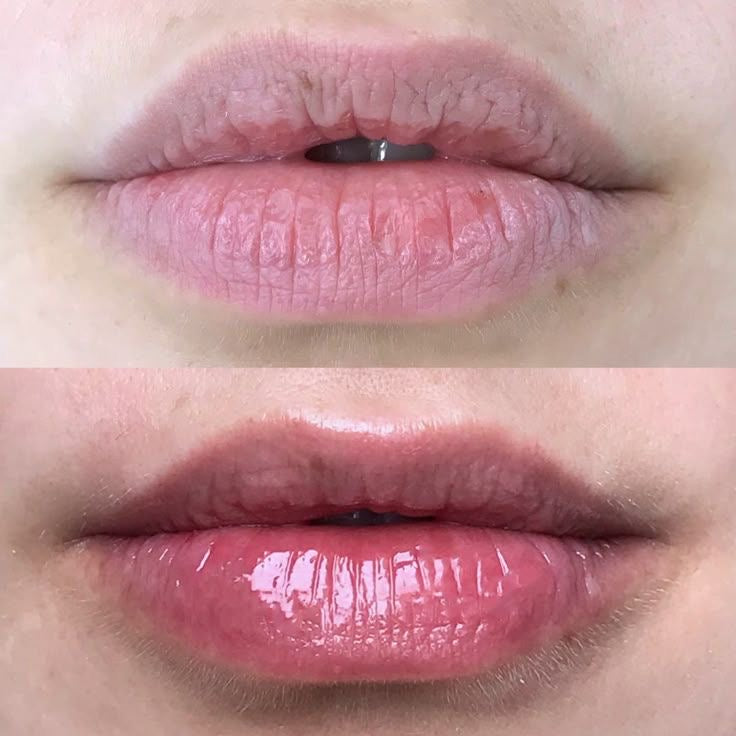 Bálsamo reparador de labios