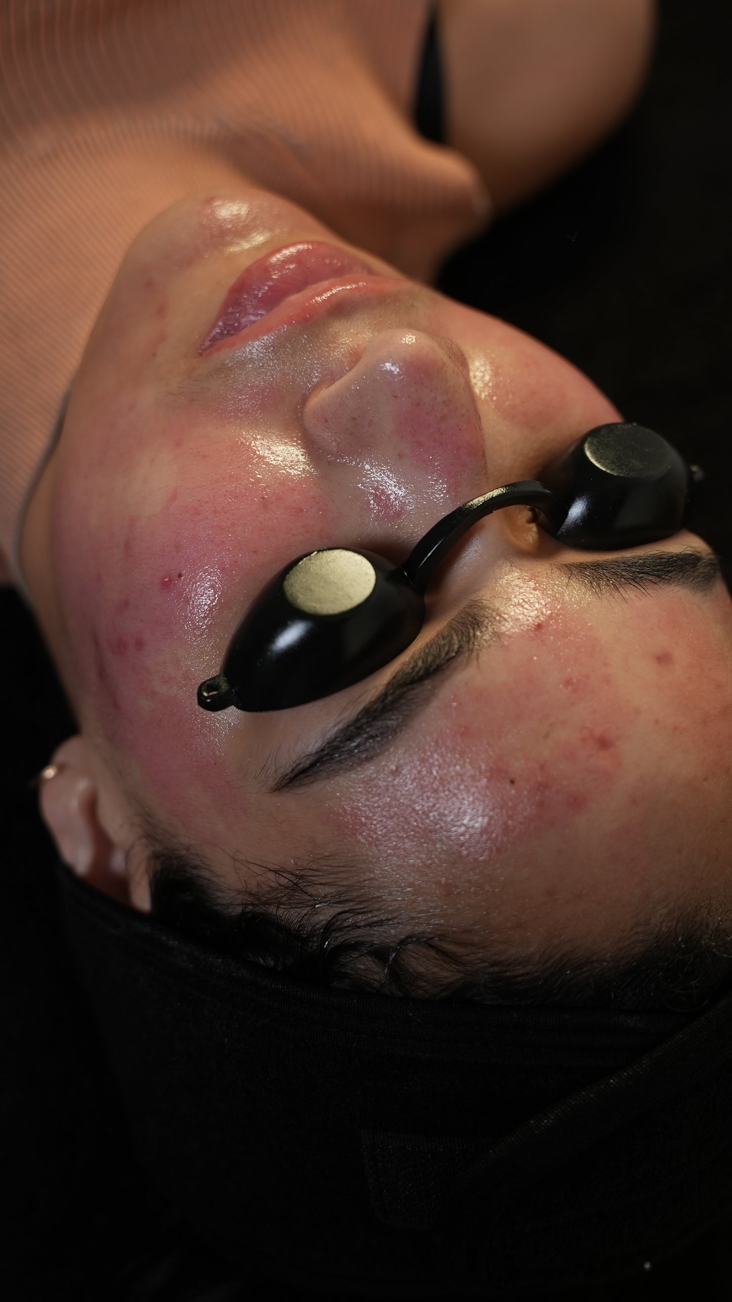 Curso Presencial  Dermapen + PDF+ Acceso a comunidad de alumnas