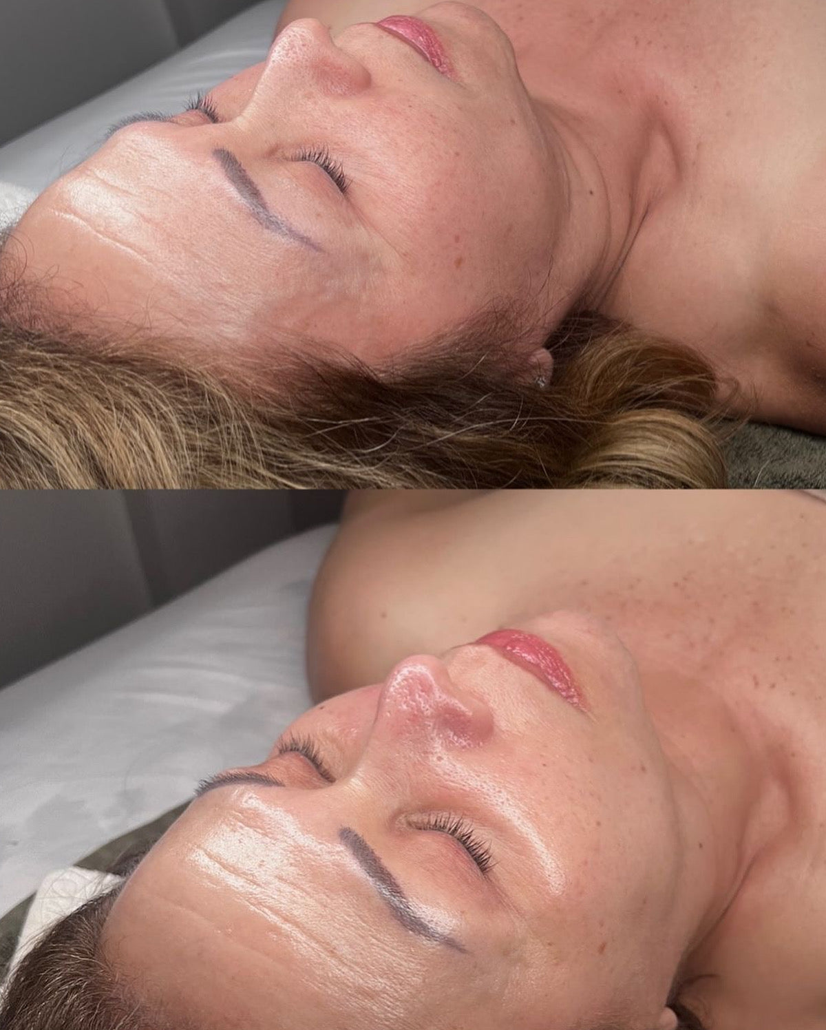 Curso higiene facial profunda (Presencial )