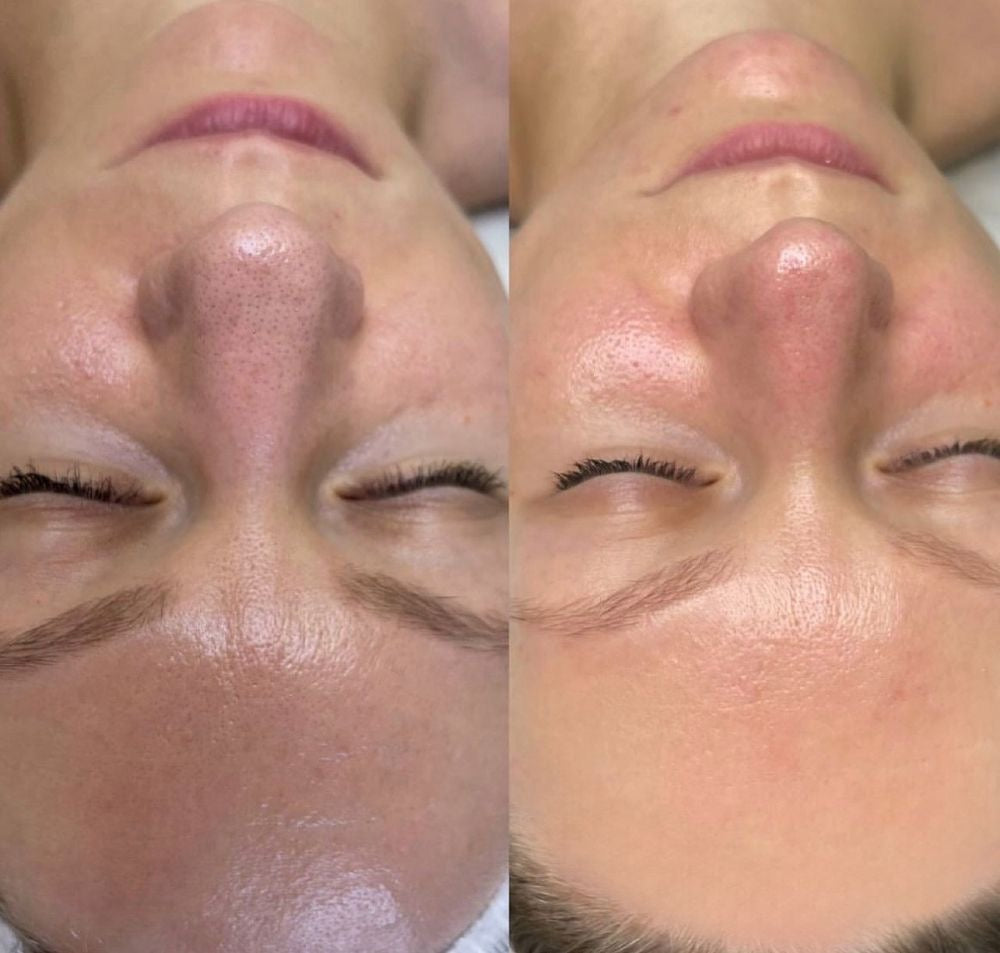 Glass Skin Coreano