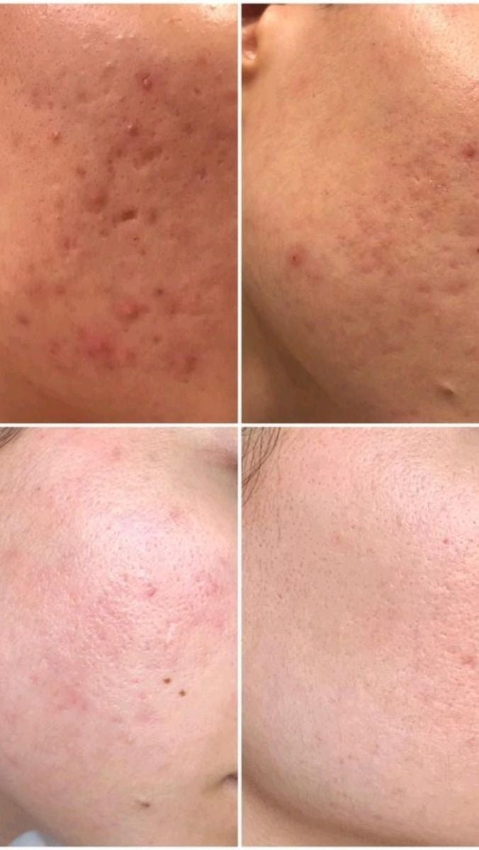 Rutina Skin Care 7 pasos