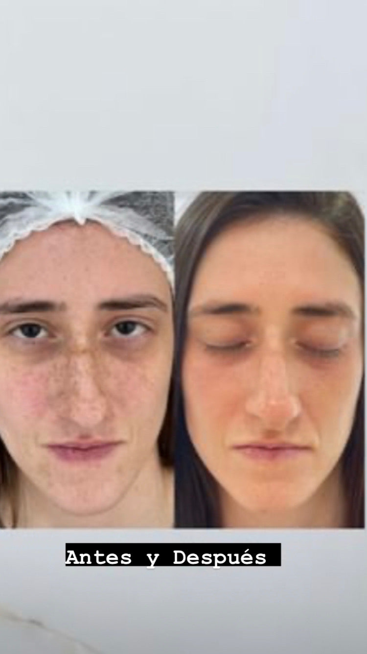 Ampolla para manchas