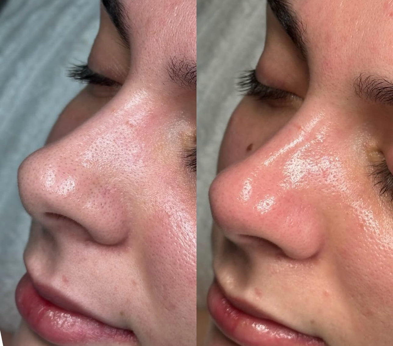 Glass Skin Coreano