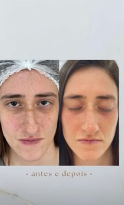 STAYVE EGF Peptide Gold Ampollas