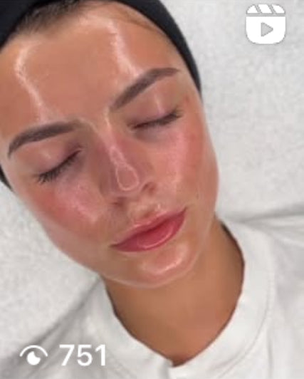 Ampollas  de inicio para dermapen