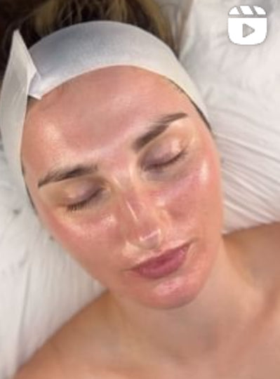 STAYVE EGF Peptide Gold Ampollas