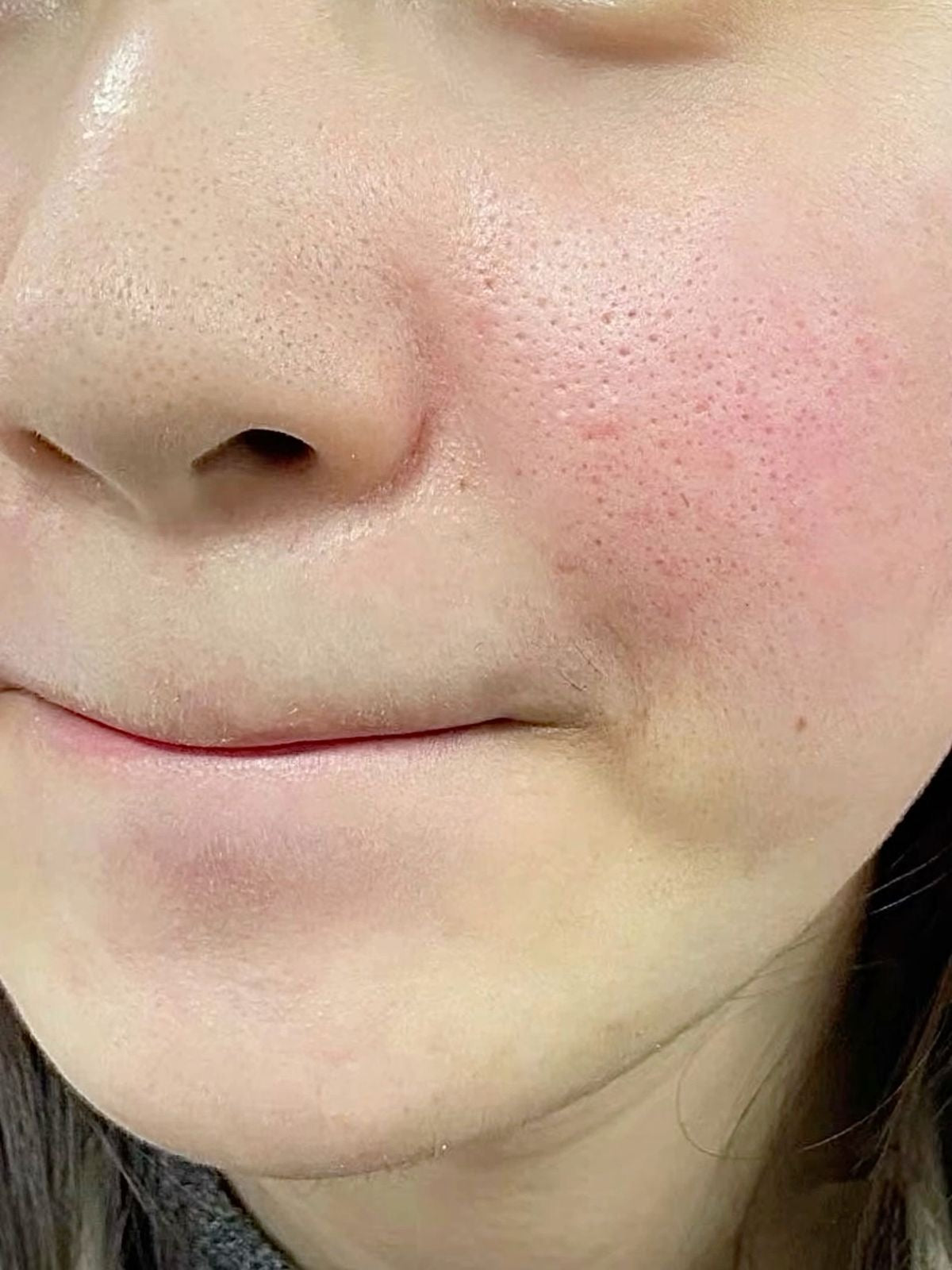 Rutina Skin Care 7 pasos