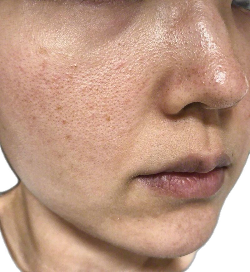 Rutina Skin Care 7 pasos