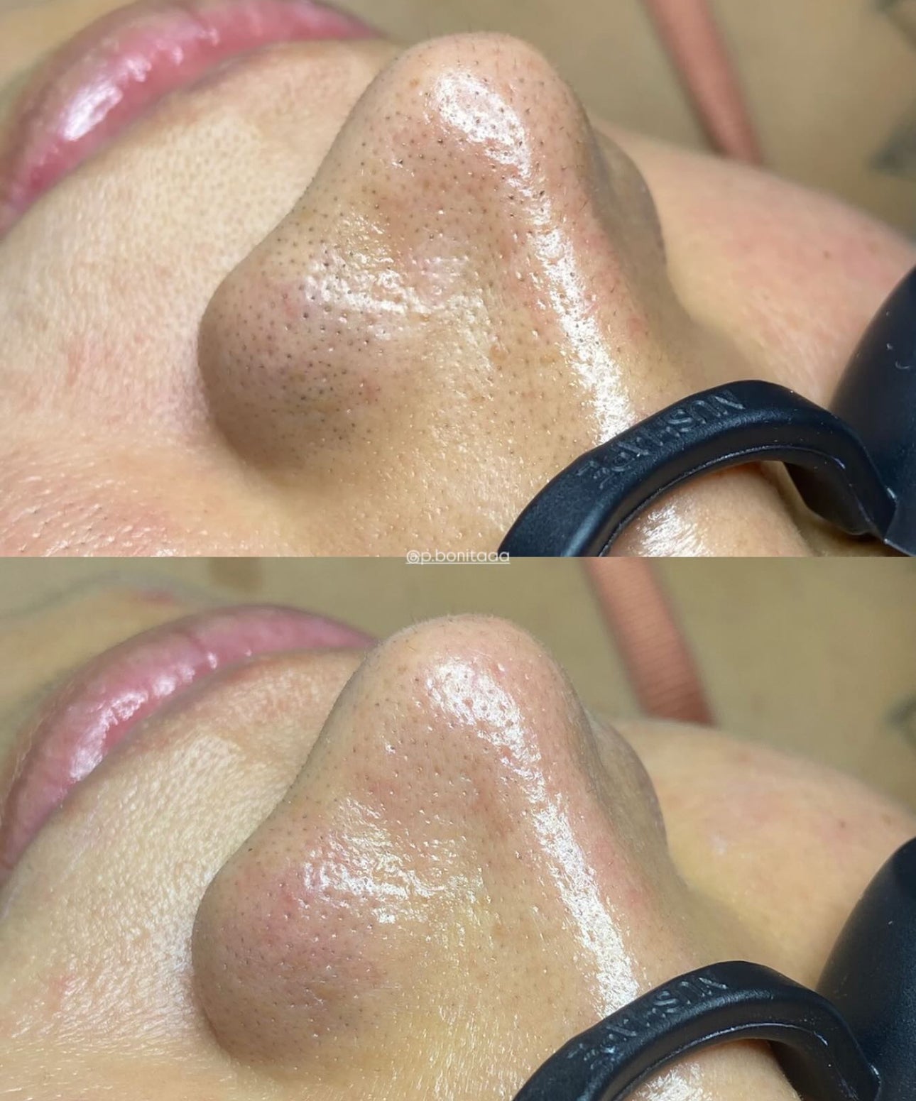 Curso higiene facial profunda (Presencial )