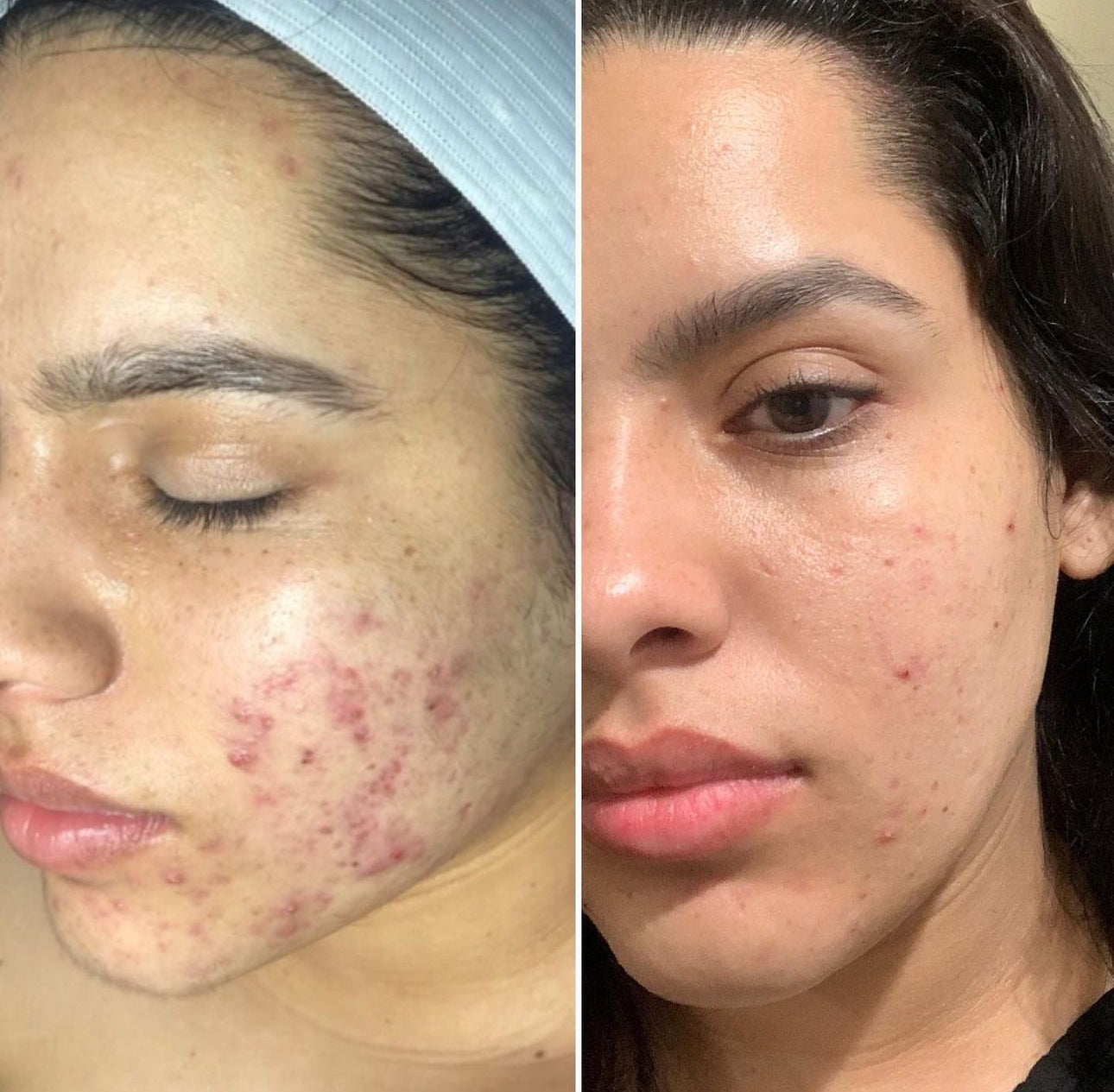 Rutina Facial Básica 3 pasos