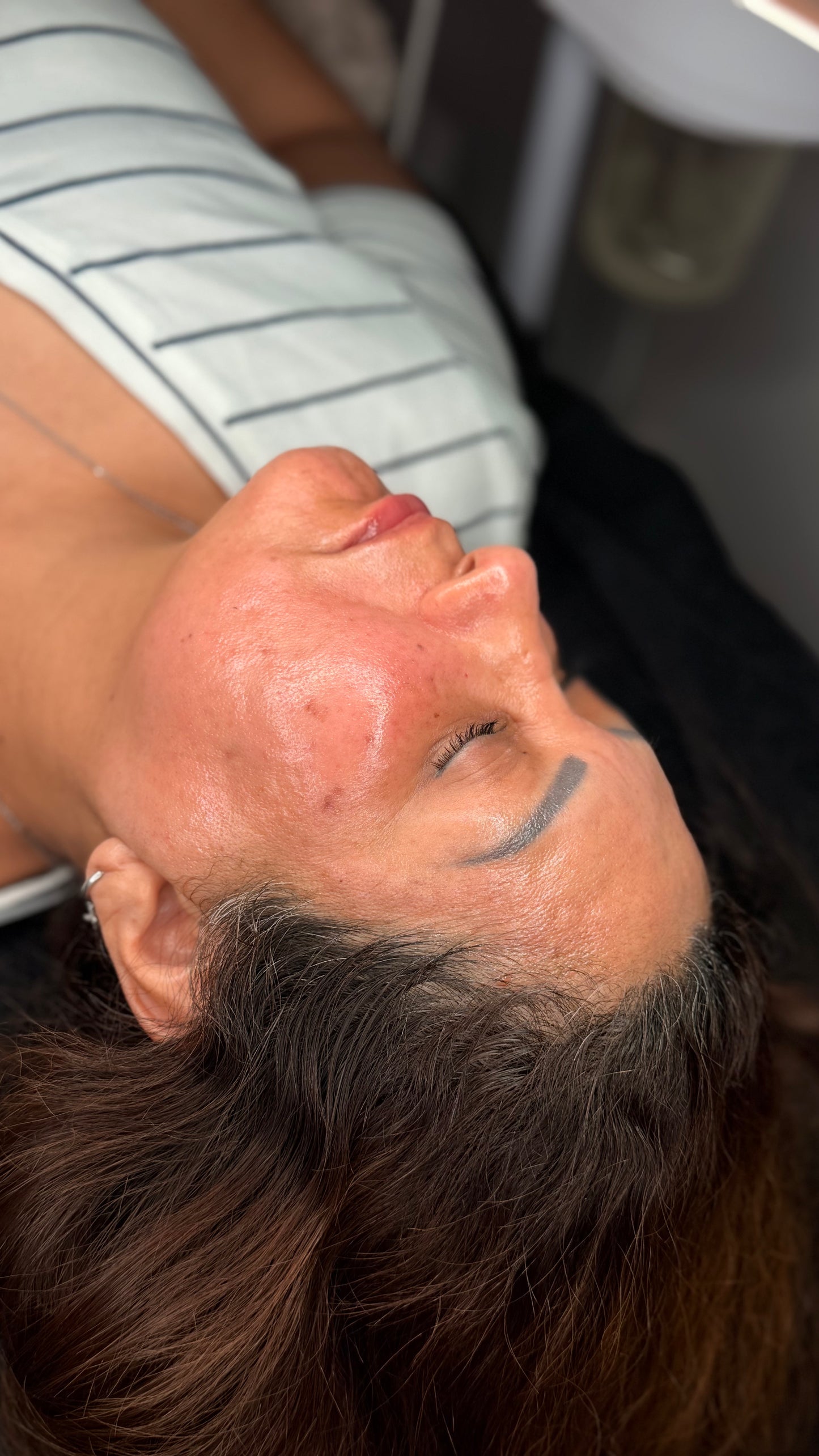 Mesoterapia