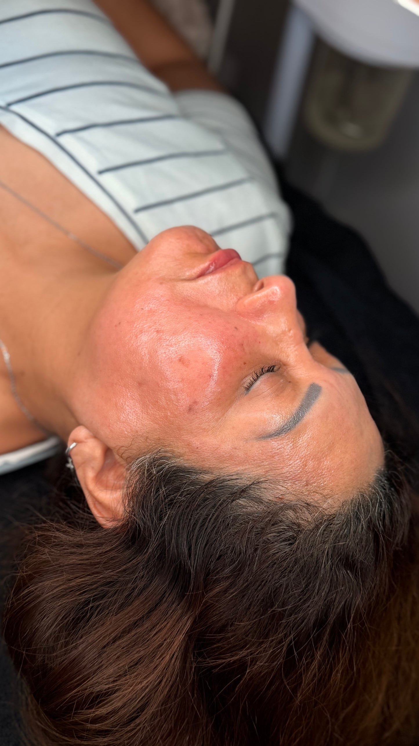 Mesoterapia
