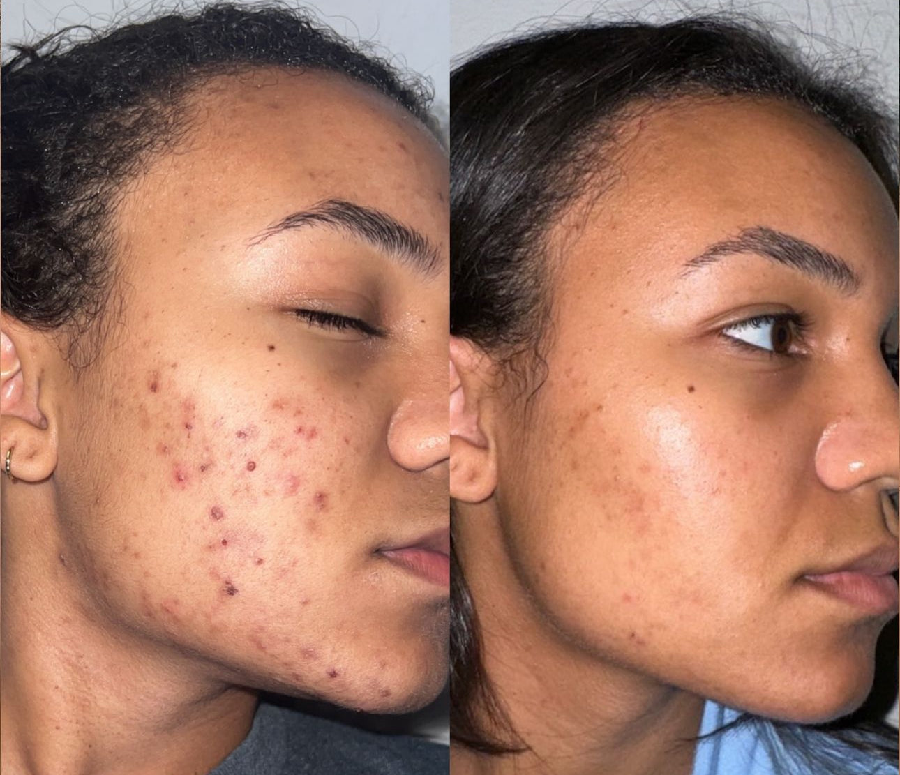 Rutina Facial Básica 3 pasos